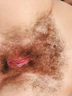 Hairy Nurse Sex Pics